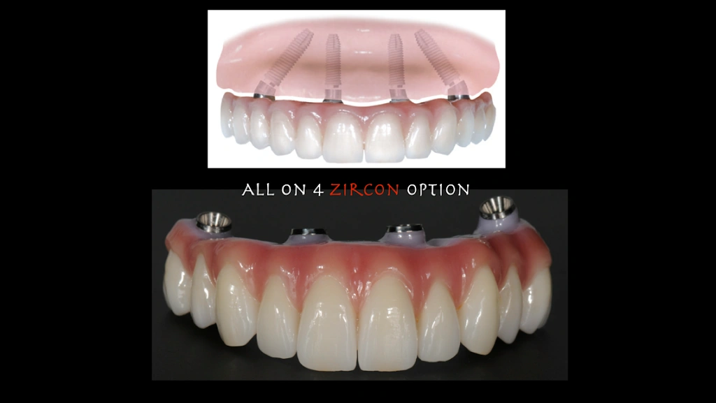 Specialists in Implant Dentistry - Dr. Matthew Holtan