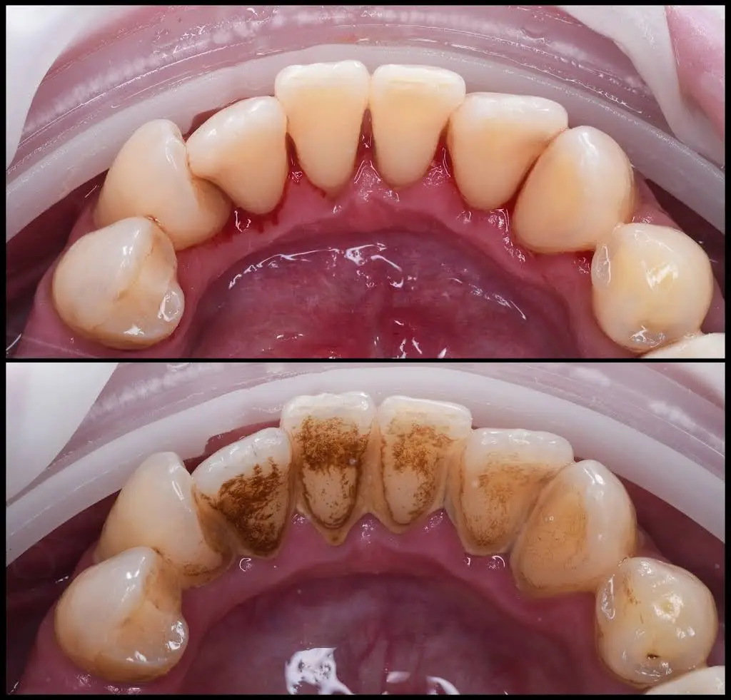 Smile Perfection Dental & Orthodontics - Professional dental clinic exterior with modern facilities