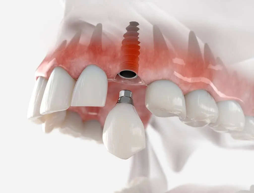 Smile Perfection Dental & Orthodontics