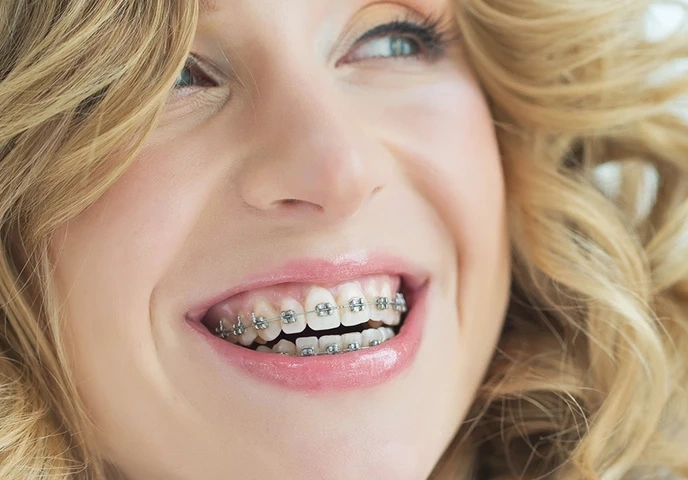 Palm Beach Braces
