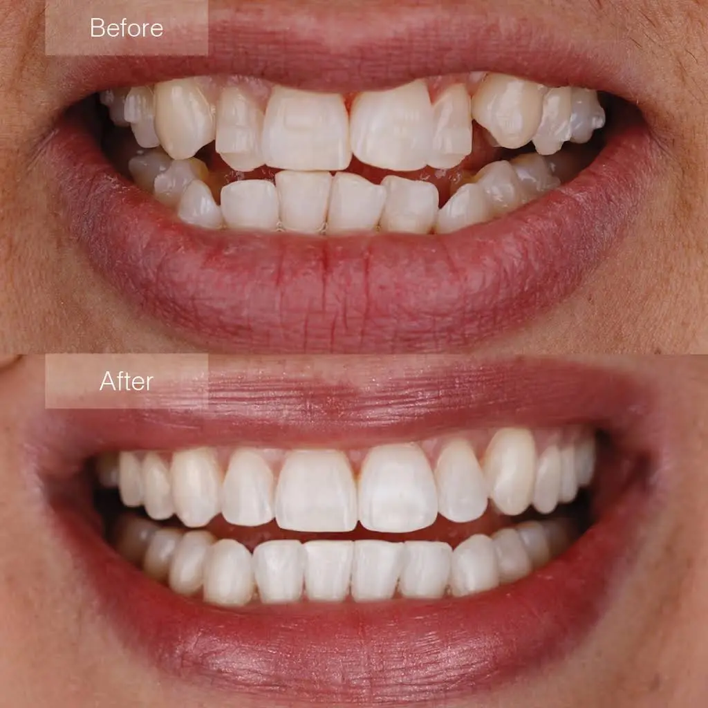 Serene Dental Spa