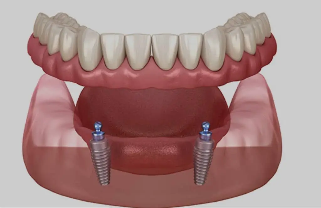 Naples Dental Boutique