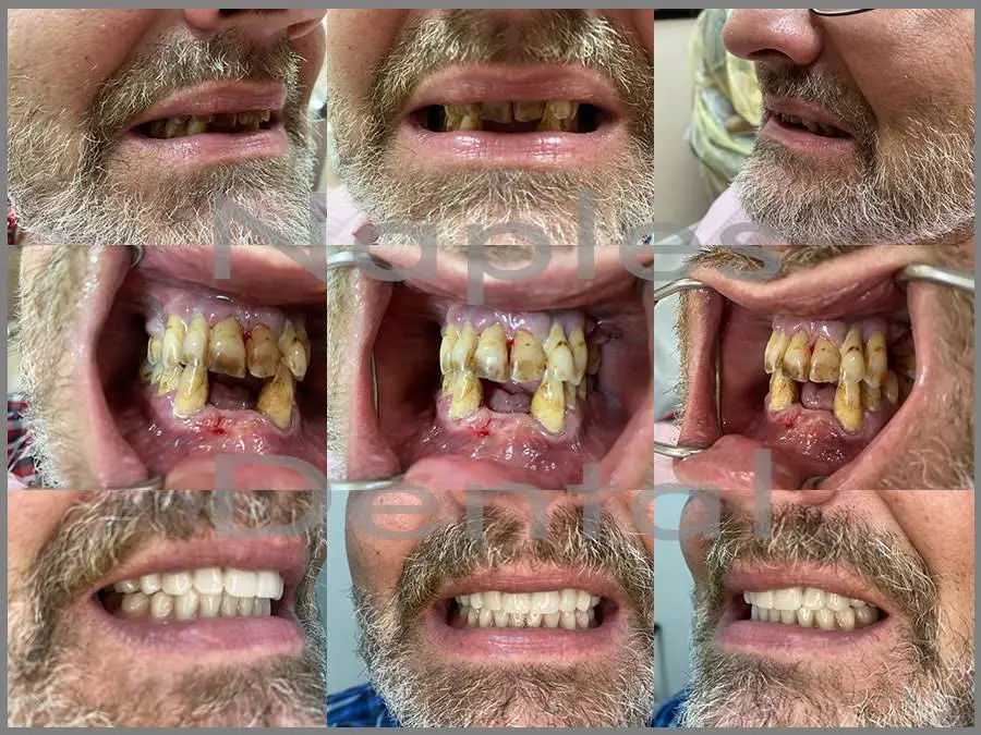 Naples Dental Care