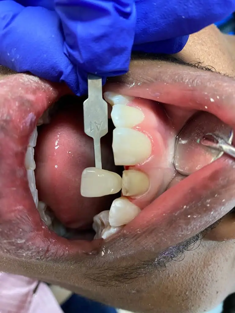 Naples Dental Care