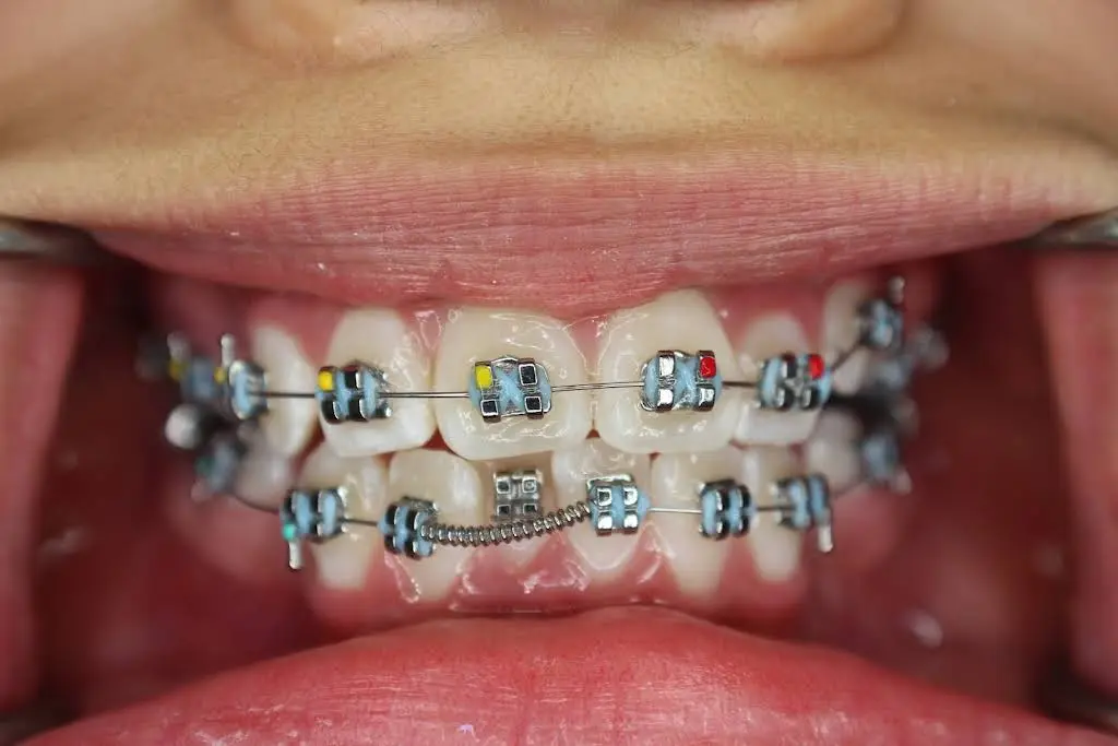 Precision Dental Care