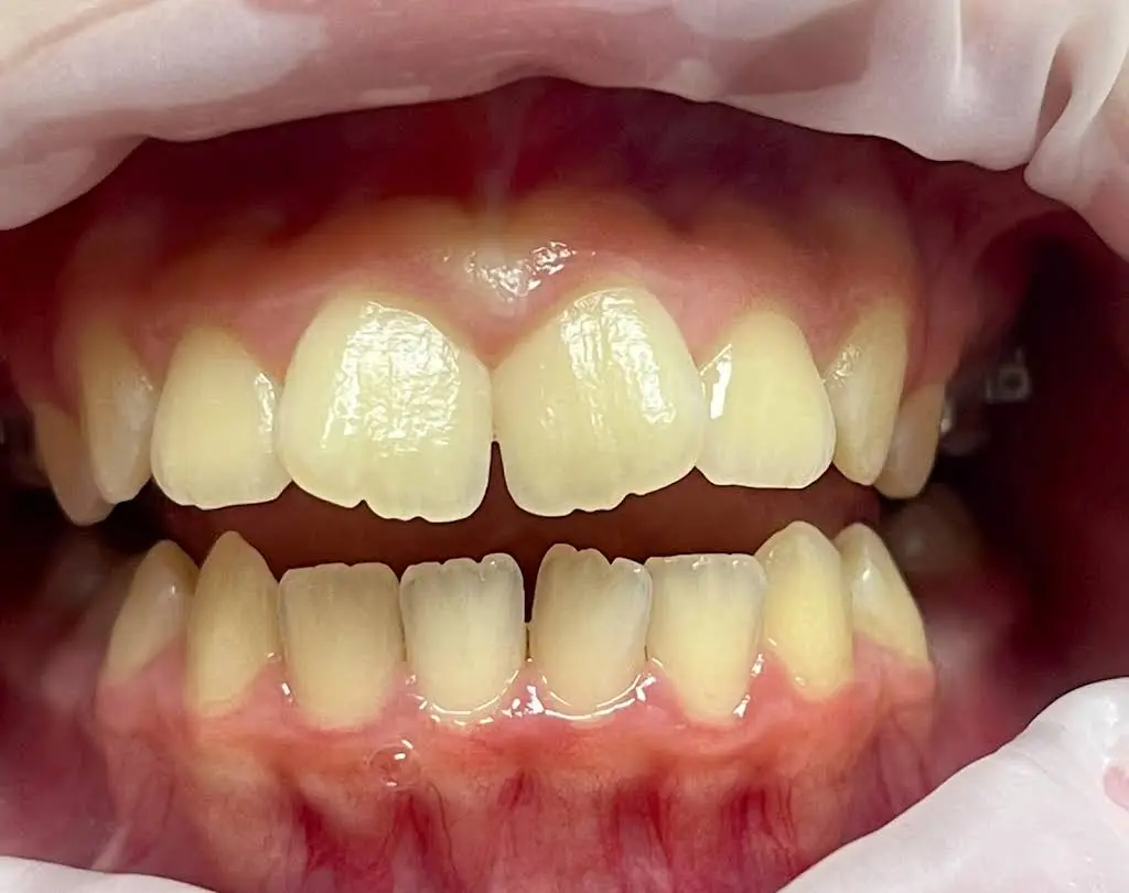Precision Dental Care