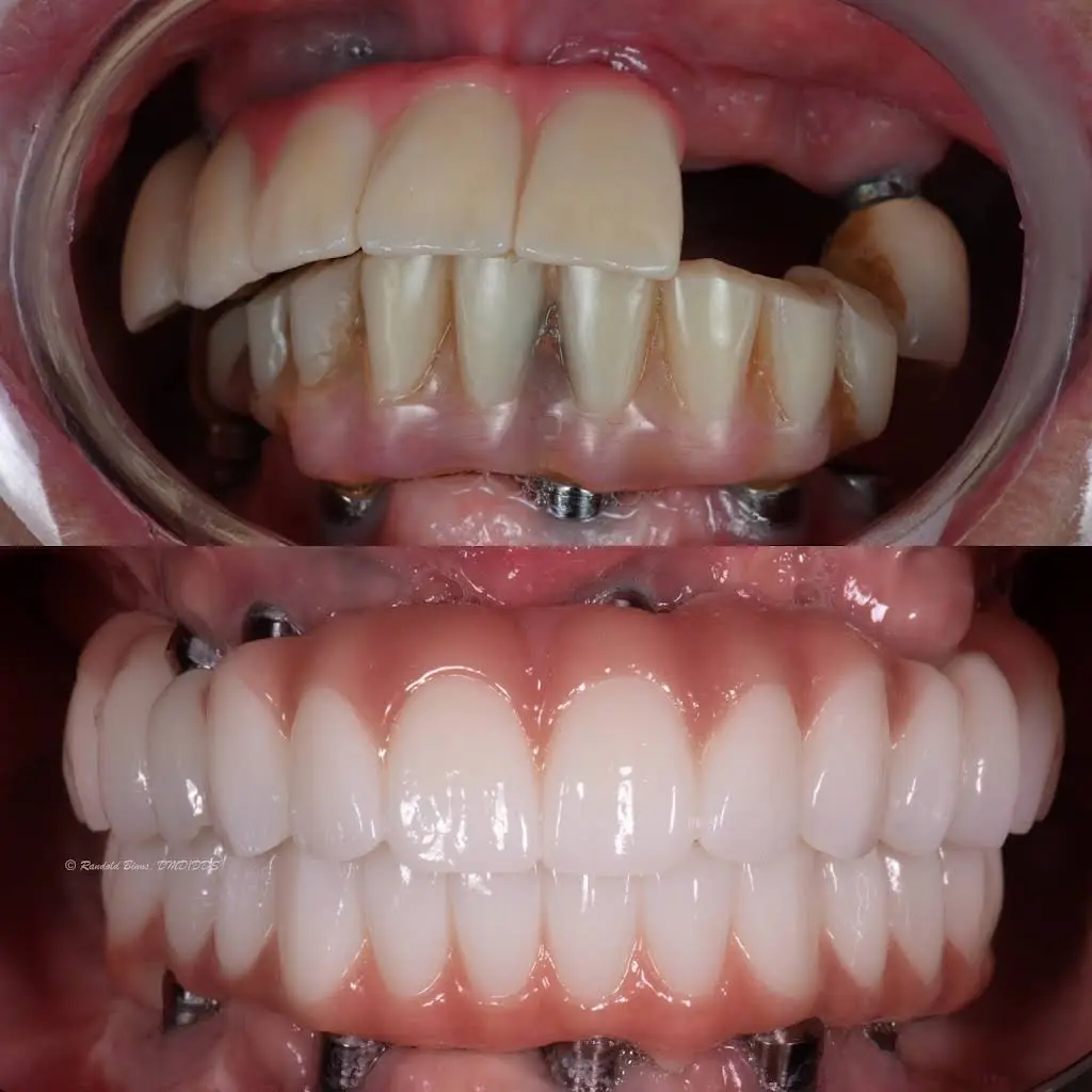 Advanced Prosthodontics & Implant Esthetics