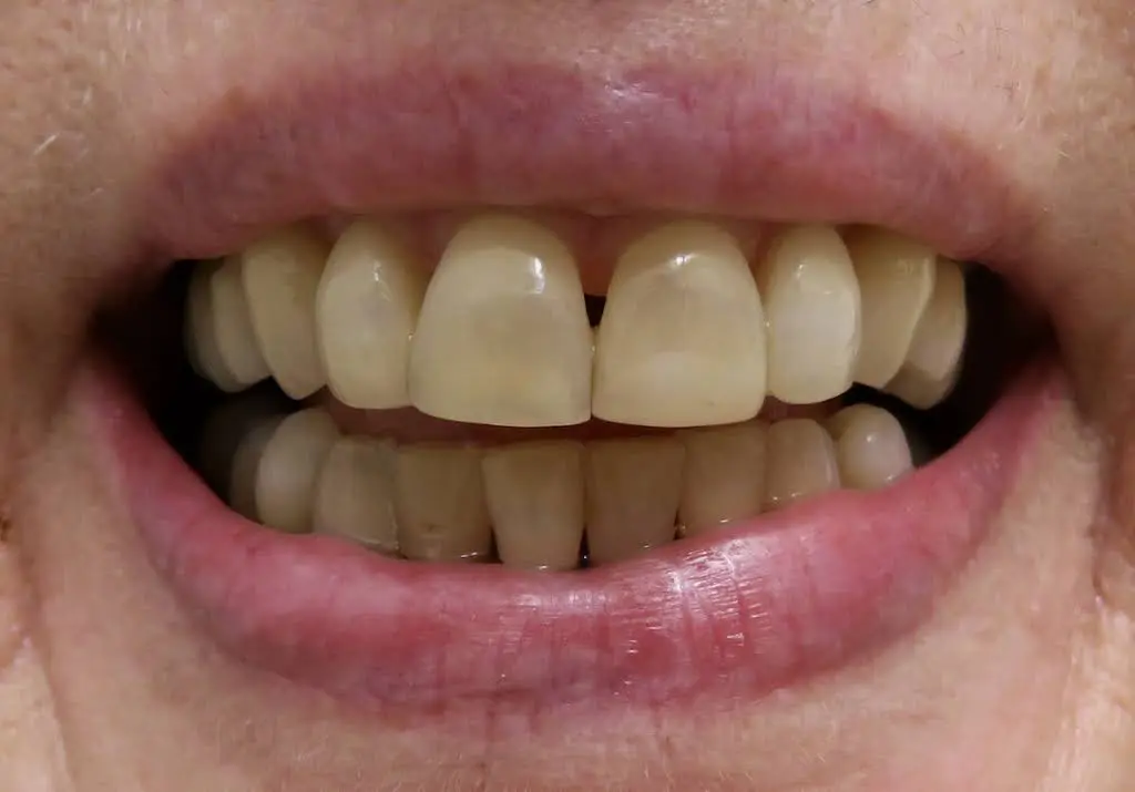 Alpha Dental