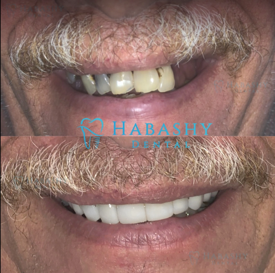 Habashy Dental