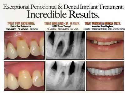 Dr. Lee R. Cohen - Palm Beach Center for Periodontics and Implant Dentistry