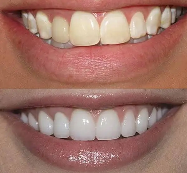 Quasha Dentistry