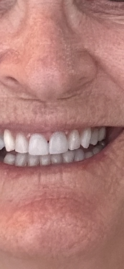 Palm Dental Professionals