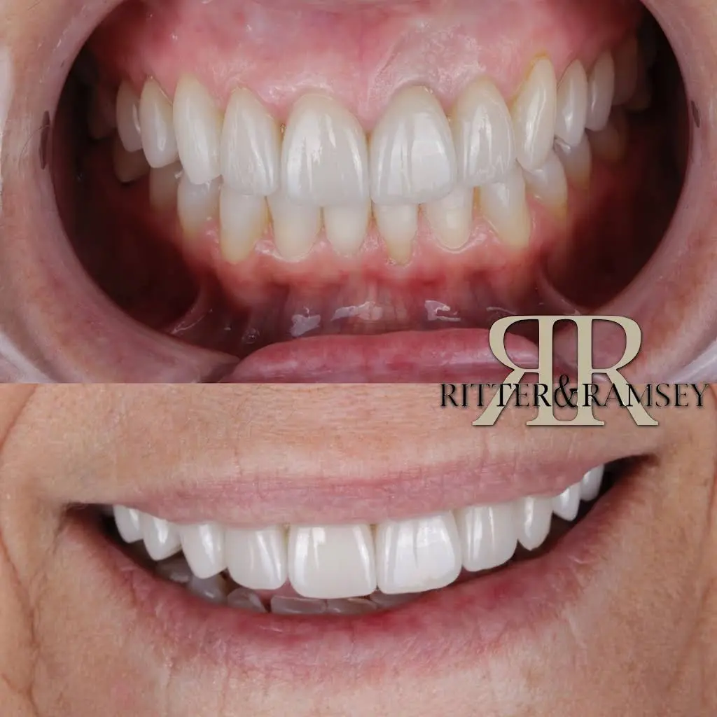 Ritter & Ramsey General and Cosmetic Dentistry
