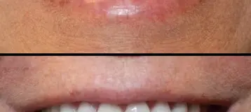 Aesthetic Dentistry at Bayfront