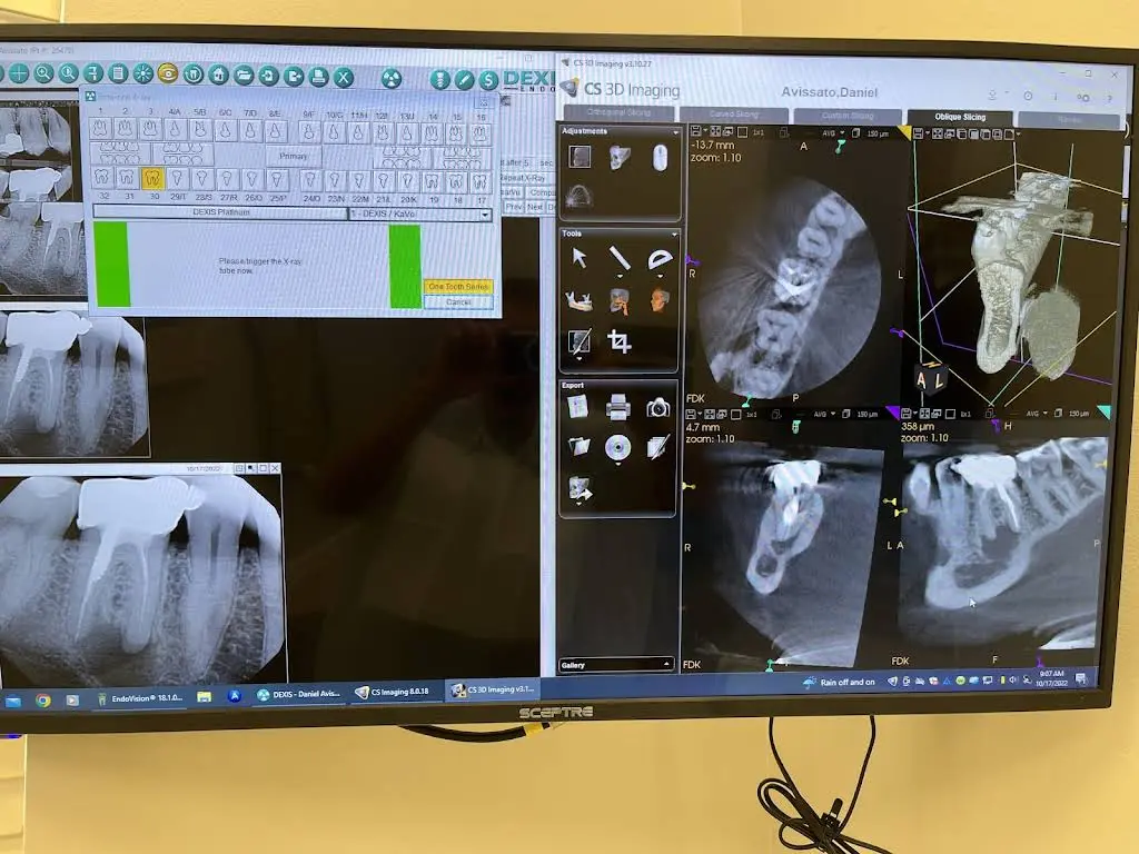 Endodontic Specialists of Naples - Dr. Kevin R. Kunz
