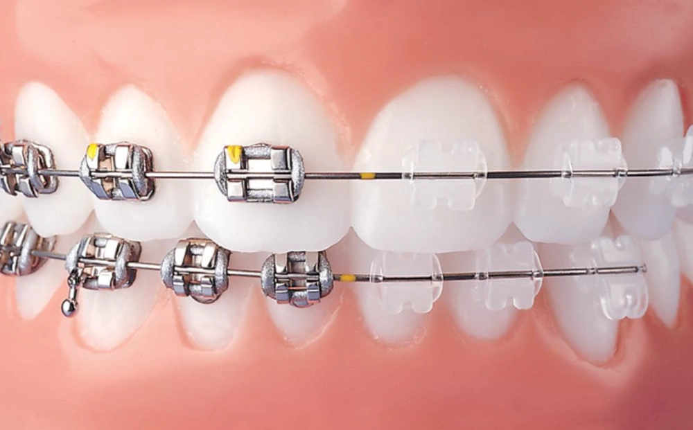 Petrover Orthodontics