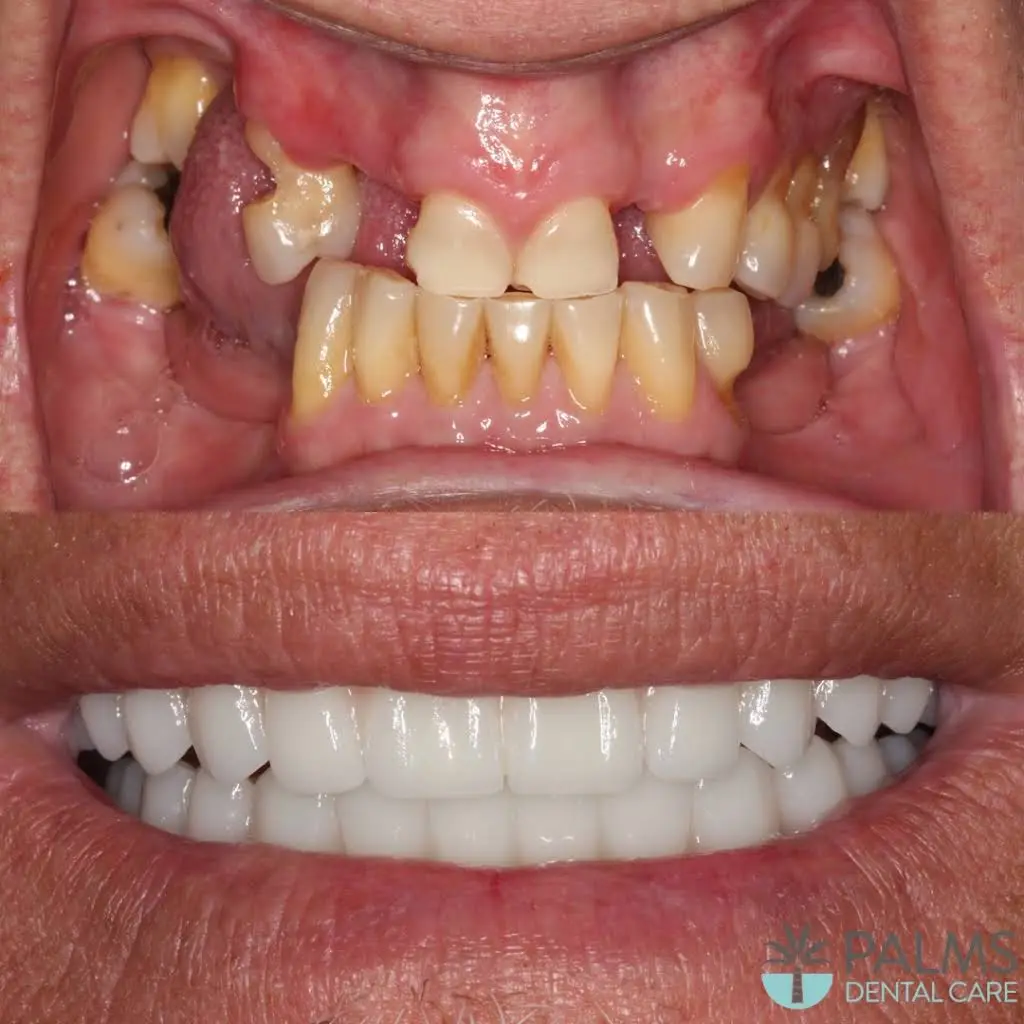 Palms Dental Care