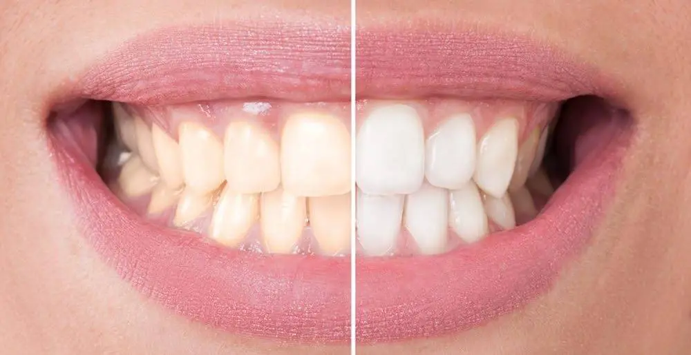 Parkridge Dental Care