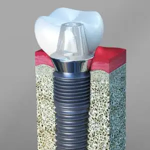 DuCoin Center for Advanced Dentistry