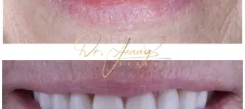 Flosswell Dental Jupiter