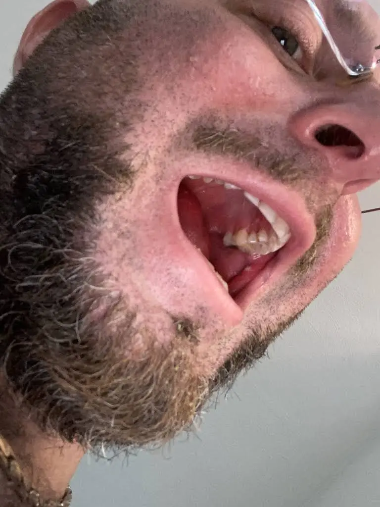 Aspen Dental
