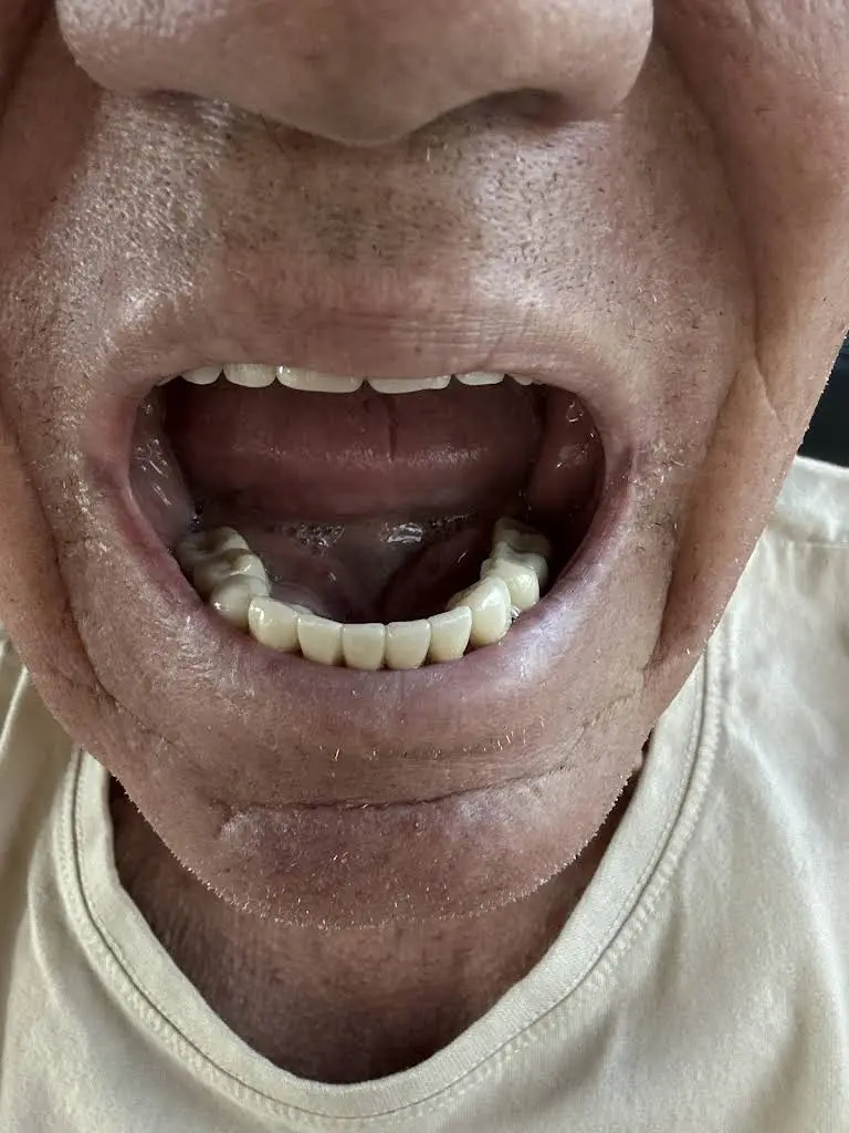 Caloosa Dental Fort Myers
