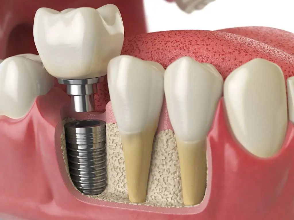 Coastal Smiles Dental Care