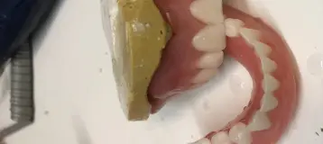 Emergency Denture Services