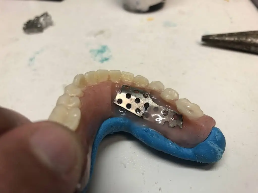 Emergency Denture Services