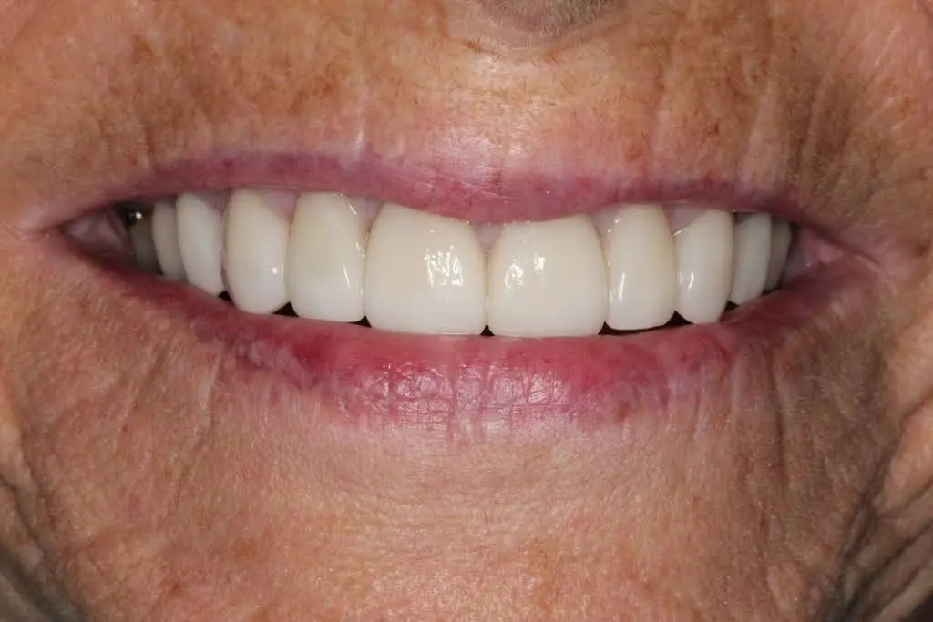 Hobe Sound Dentistry