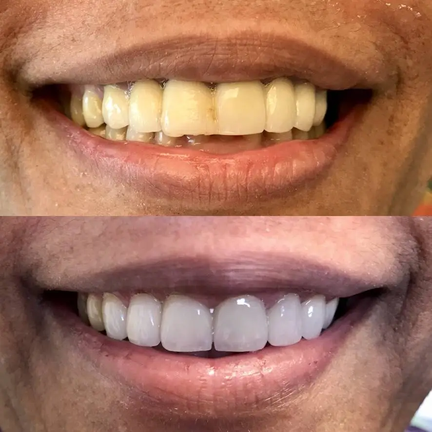 Hobe Sound Dentistry