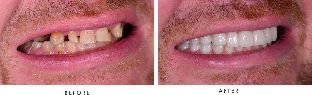 Marsh Cove Dental and Implant Center - Fort Myers