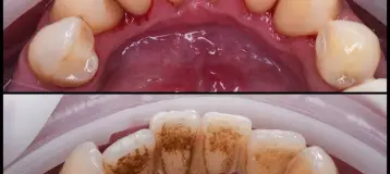 Smile Perfection Dental & Orthodontics