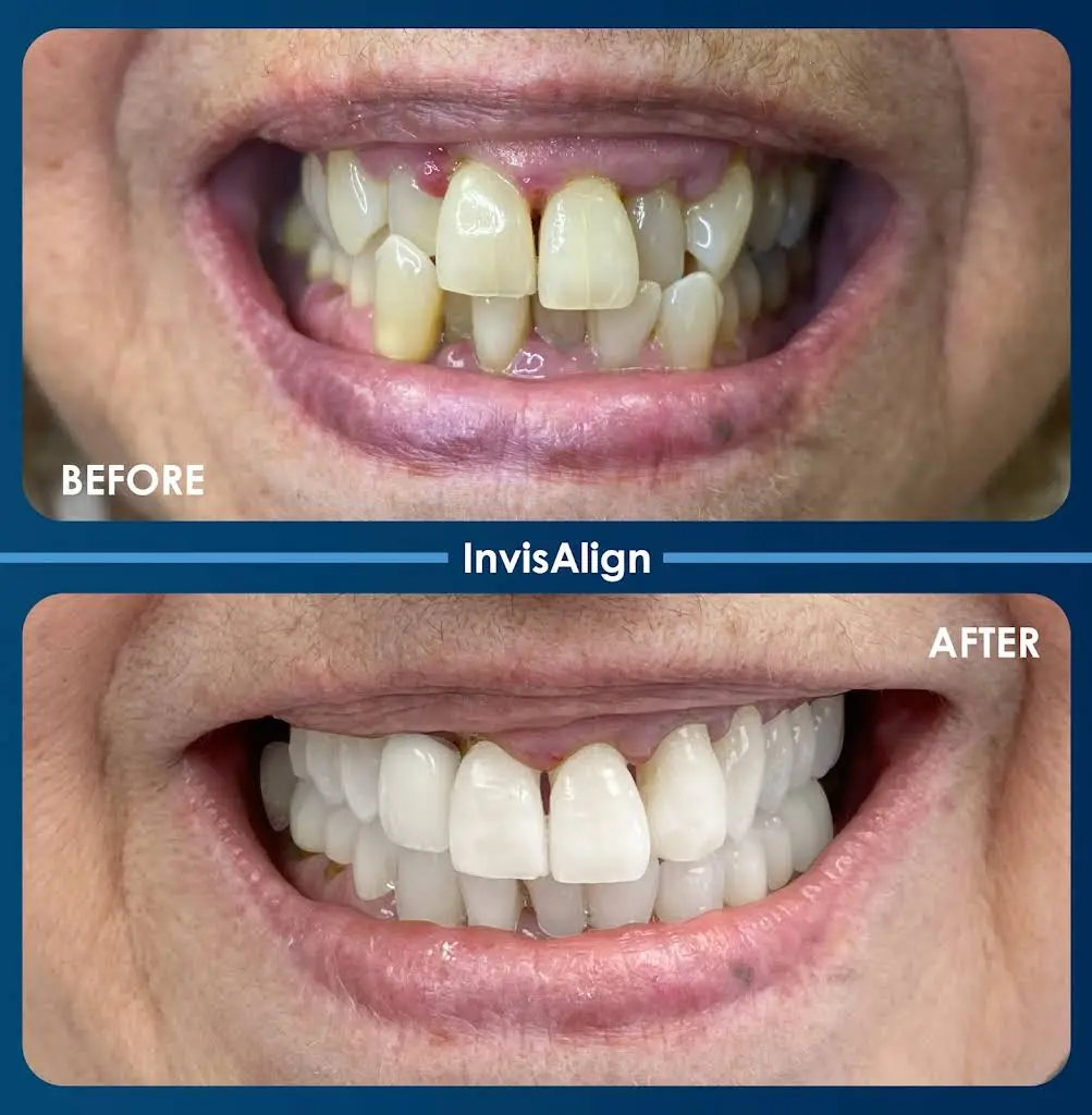 BTC Dental