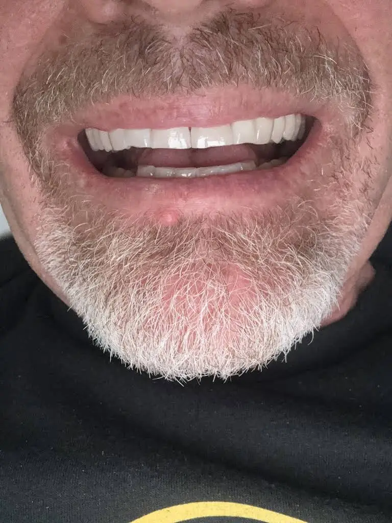 Towncare Dental of Forest Hill