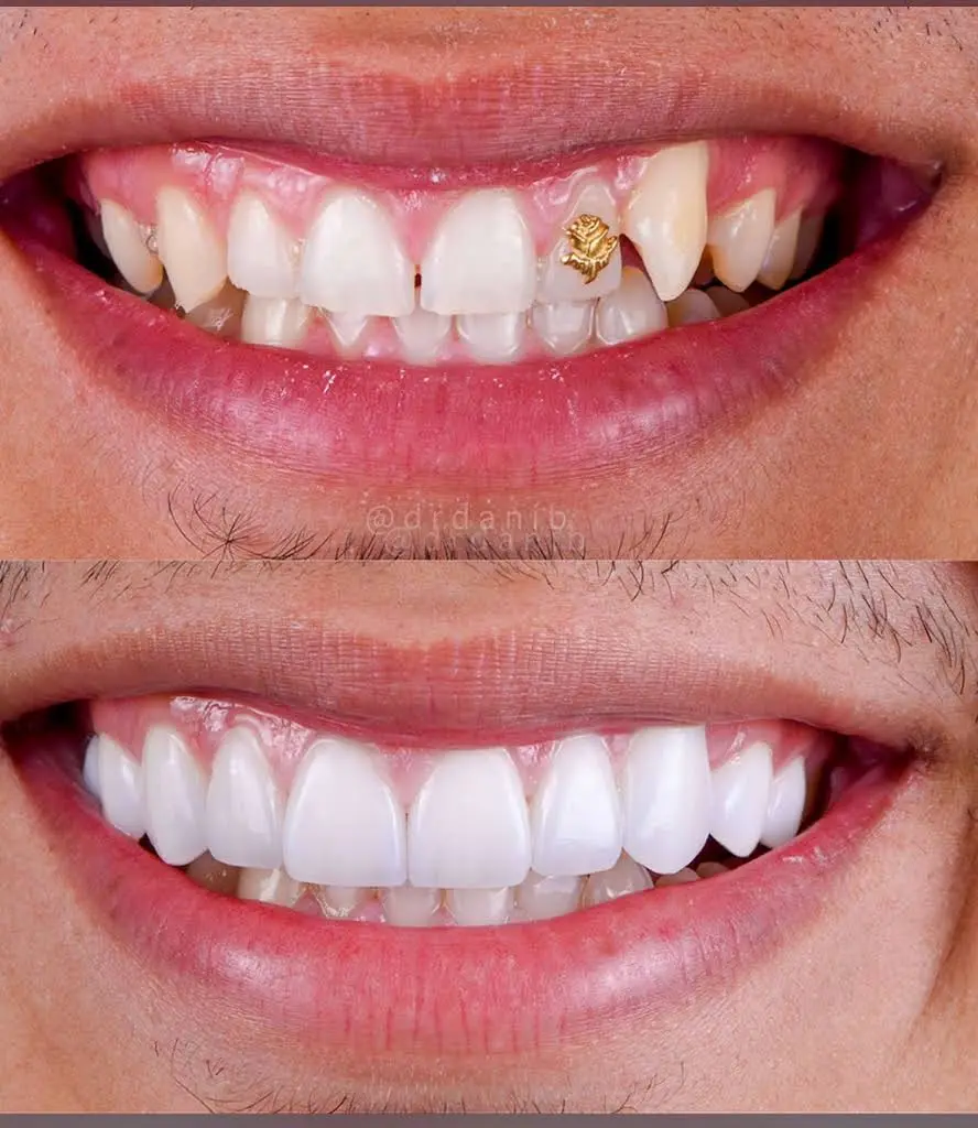 Palm Beach Institute of Dentistry