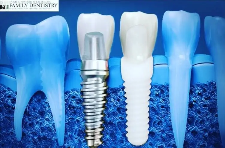 Hugh B Rosenblatt, DMD, PA - Boynton Beach Family Dentistry