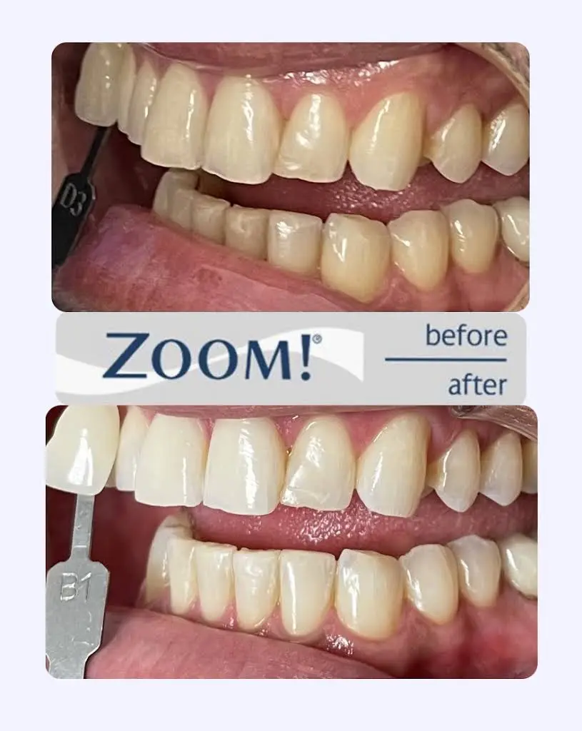 Sunset Smiles Dental - Lake Worth