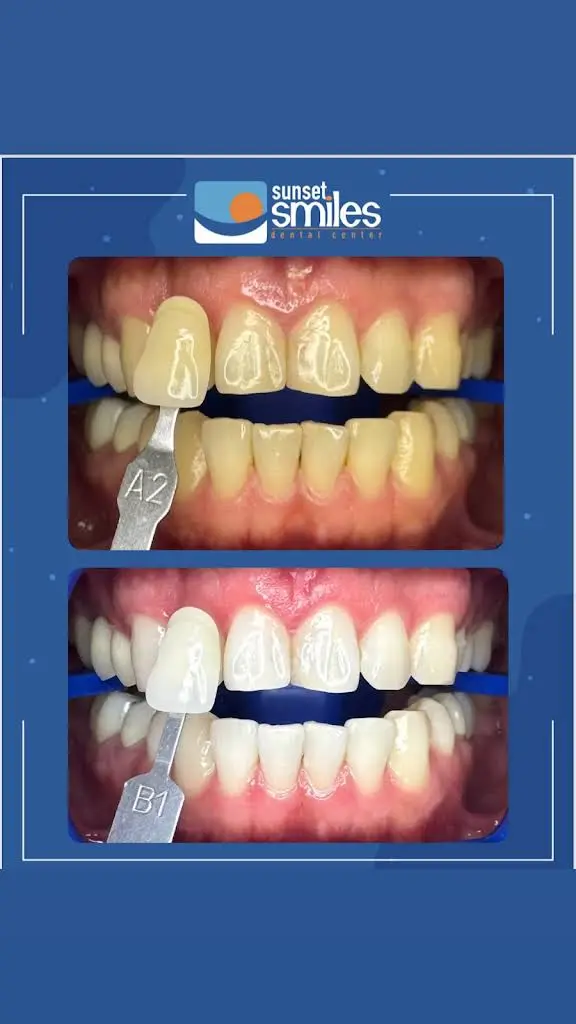 Sunset Smiles Dental - Lake Worth