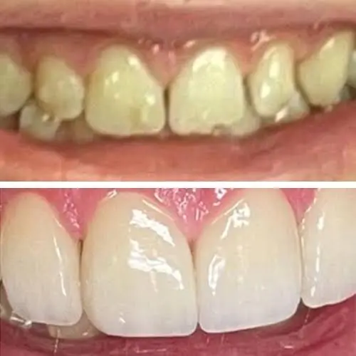 Quantum Dental