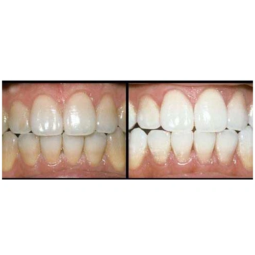 Emergency Dental