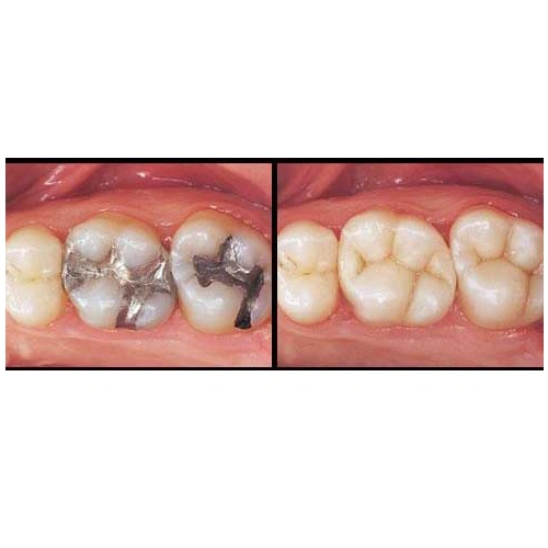 Emergency Dental