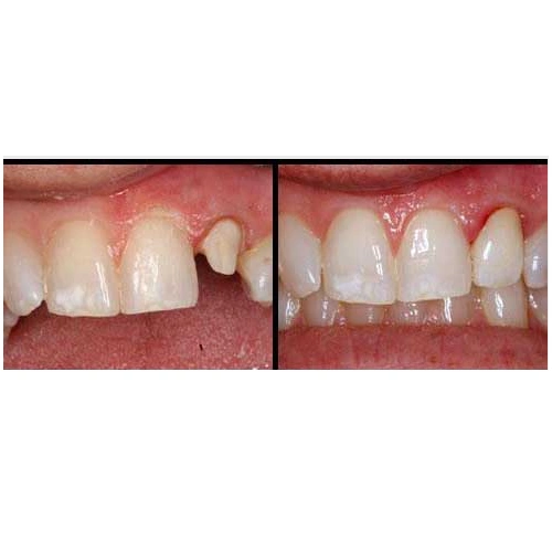 Emergency Dental