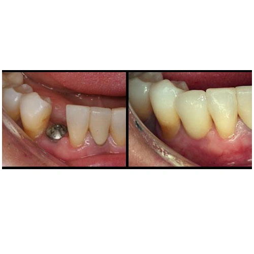 Emergency Dental