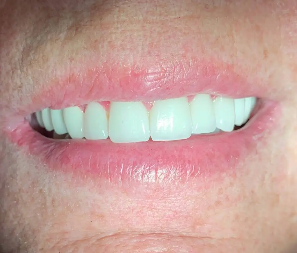 Apex Dentistry - Fort Pierce
