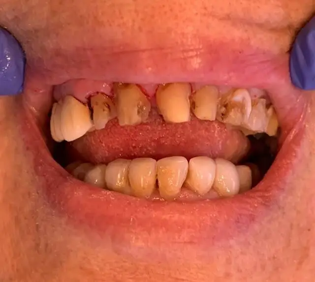 Apex Dentistry - Fort Pierce