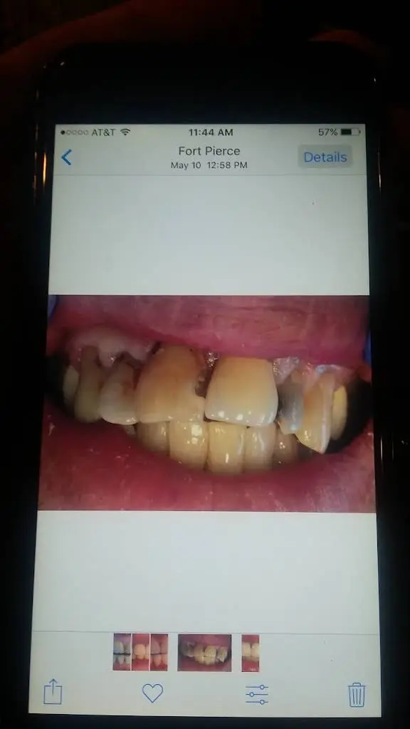 Apex Dentistry - Fort Pierce