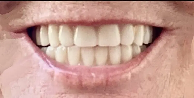 Dentures Today