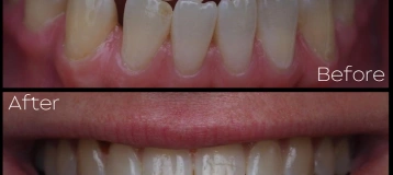 Coastline Family Dental & Implants