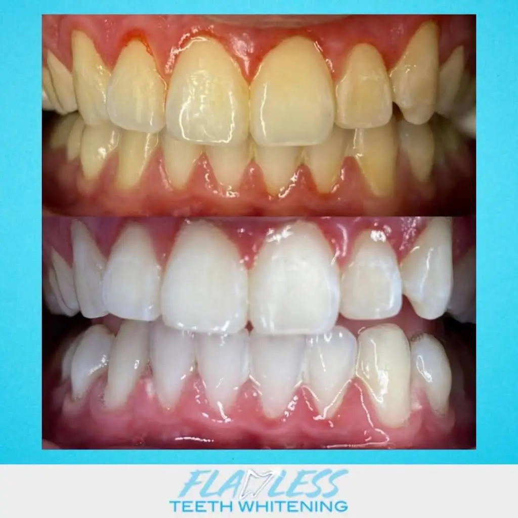Flawless Teeth Whitening - Professional dental clinic exterior with modern facilities